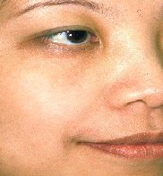 dermalive_i2b.jpg 182x196