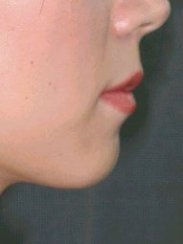 dermalive_i3a.jpg 191x255