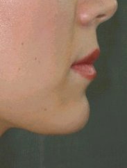 dermalive_i3b.jpg 193x255