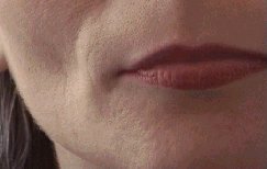 dermalive_i4a.jpg 243x154