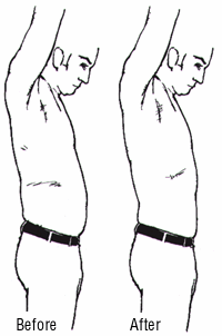 tummy