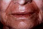 lr_t2_small_after.jpg 146x99