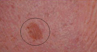 Pigmented