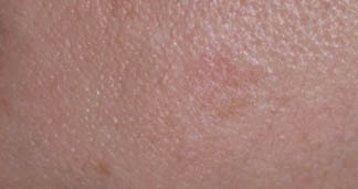 Pigmented